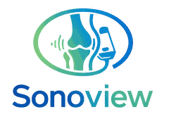 Sonoview